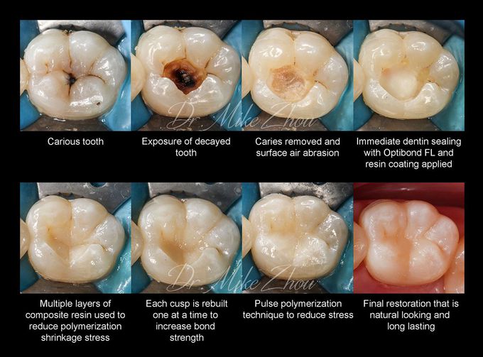 Biomimetic Restoration