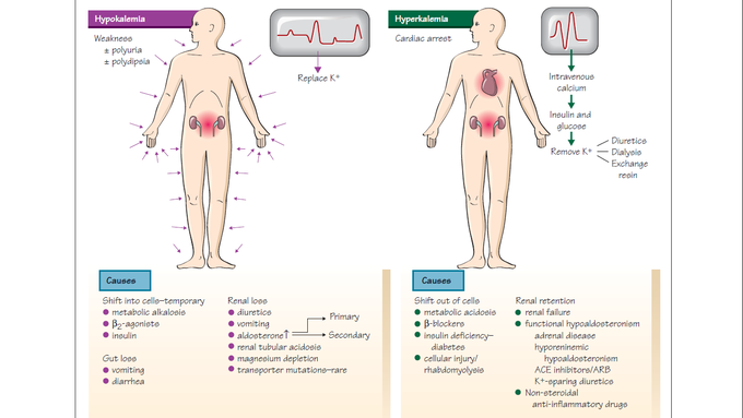 Hyerkalaemia and hypokalaemia