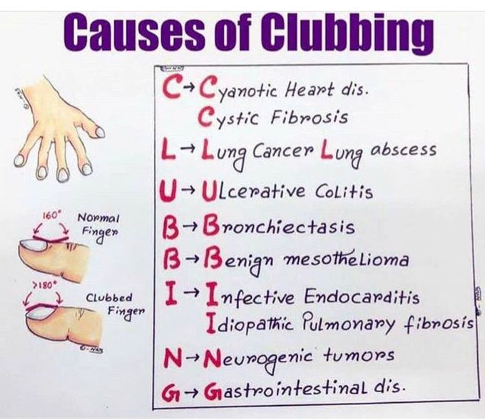 Clubbing causes