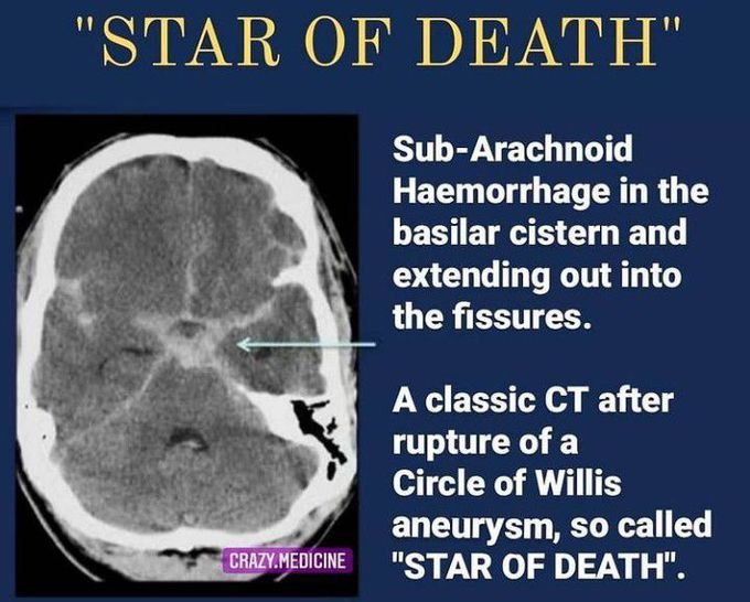 Star of death