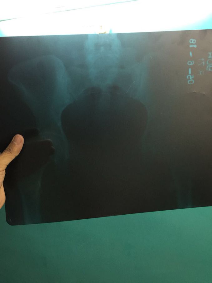 suggest diagnosis ??