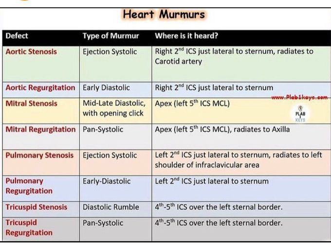 Murmurs II