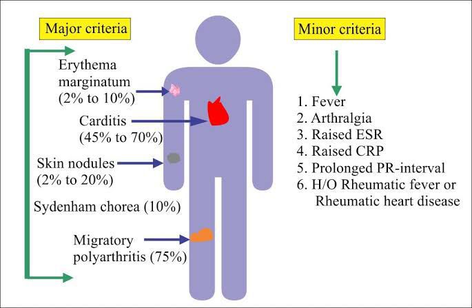 Rheumatic Fever MEDizzy