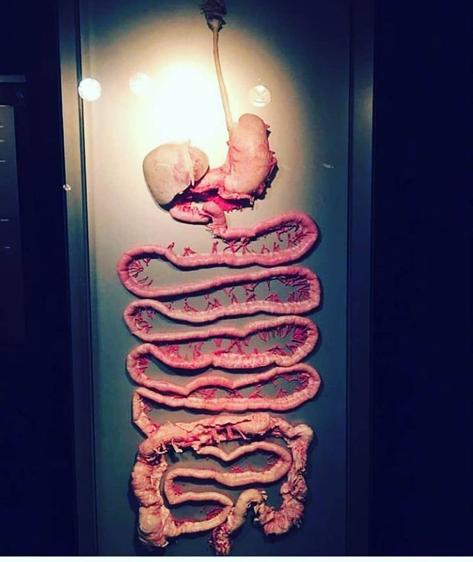 Human GIT in well dissected form.