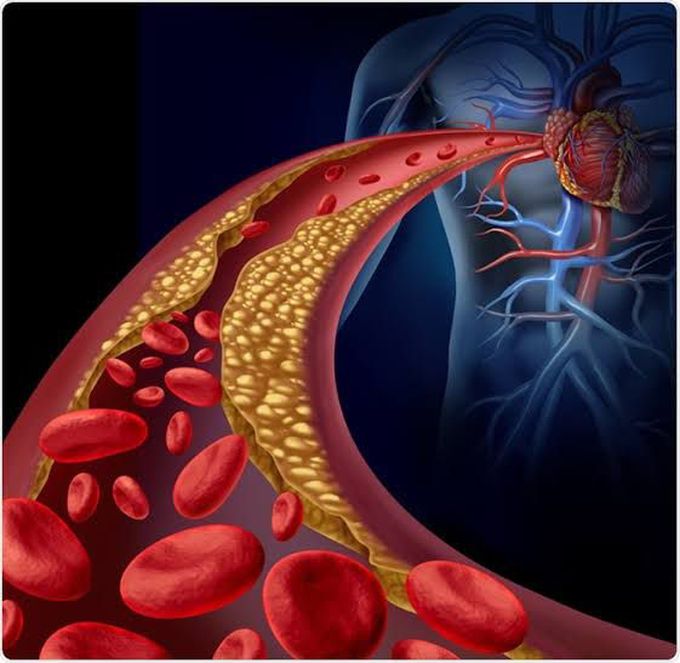 Blood clotting disorder causes