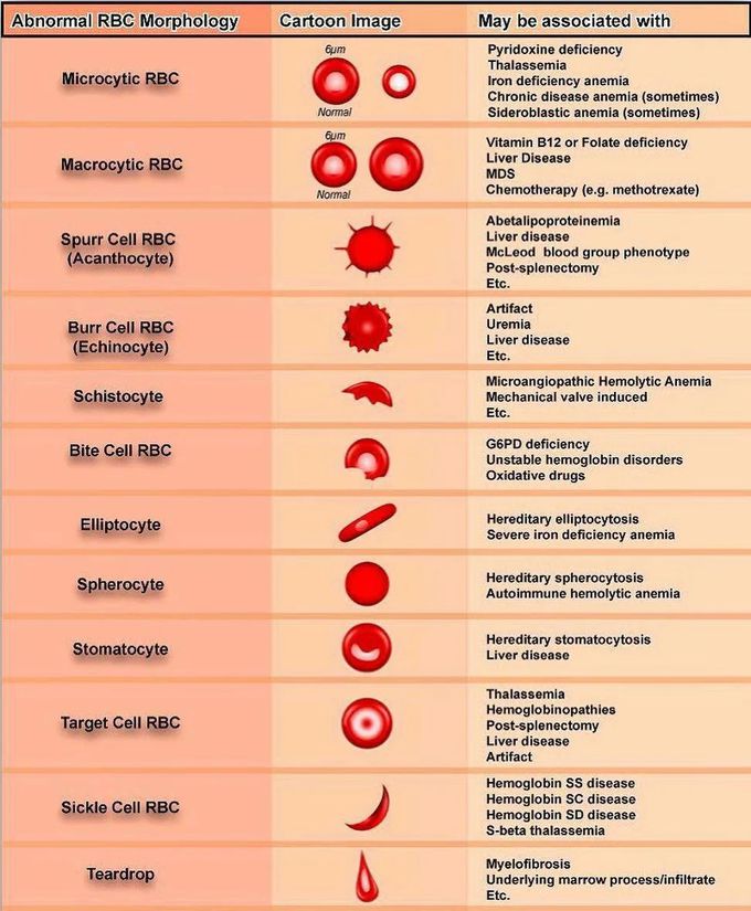 Abnormalities of RBCs