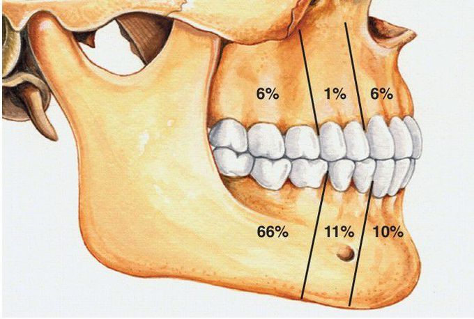 Ameloblastoma distribution