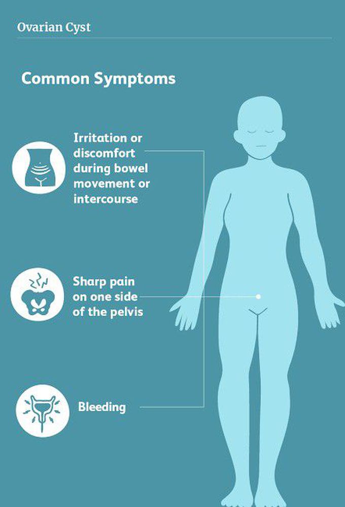 Symptoms for ruptured ovarian cyst - MEDizzy