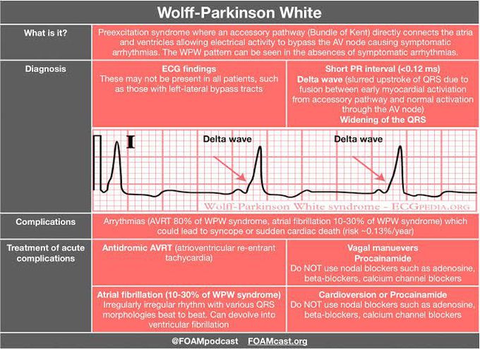 Wolf-Parkinson white  Syndrome