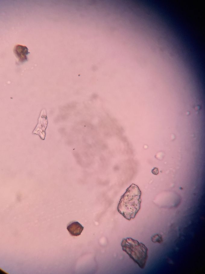MICROSCOPIC EXAMINATION OF URINE SAMPLE