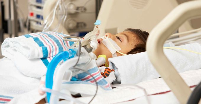 Complications of Prolonged Mechanical Ventilation