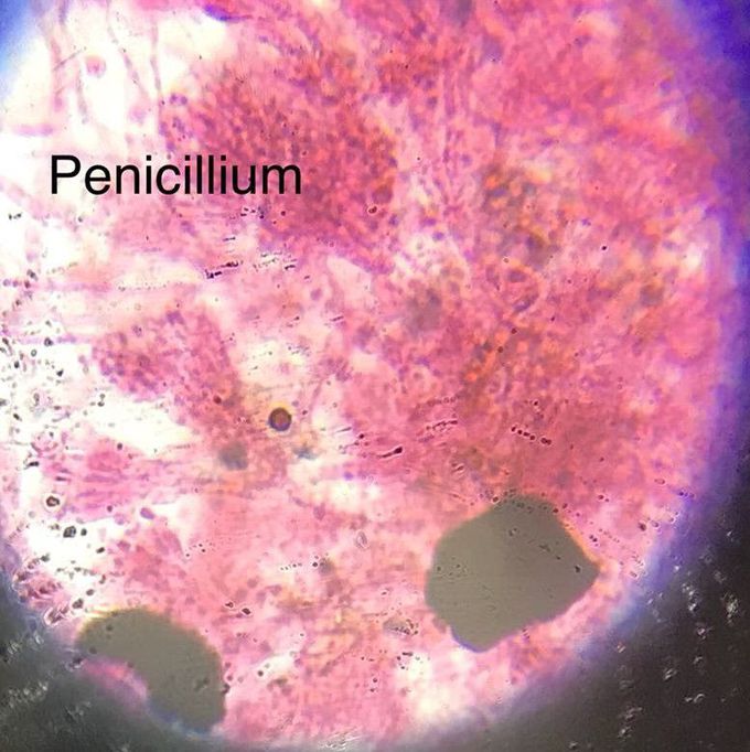 penicillium under microscope 400x