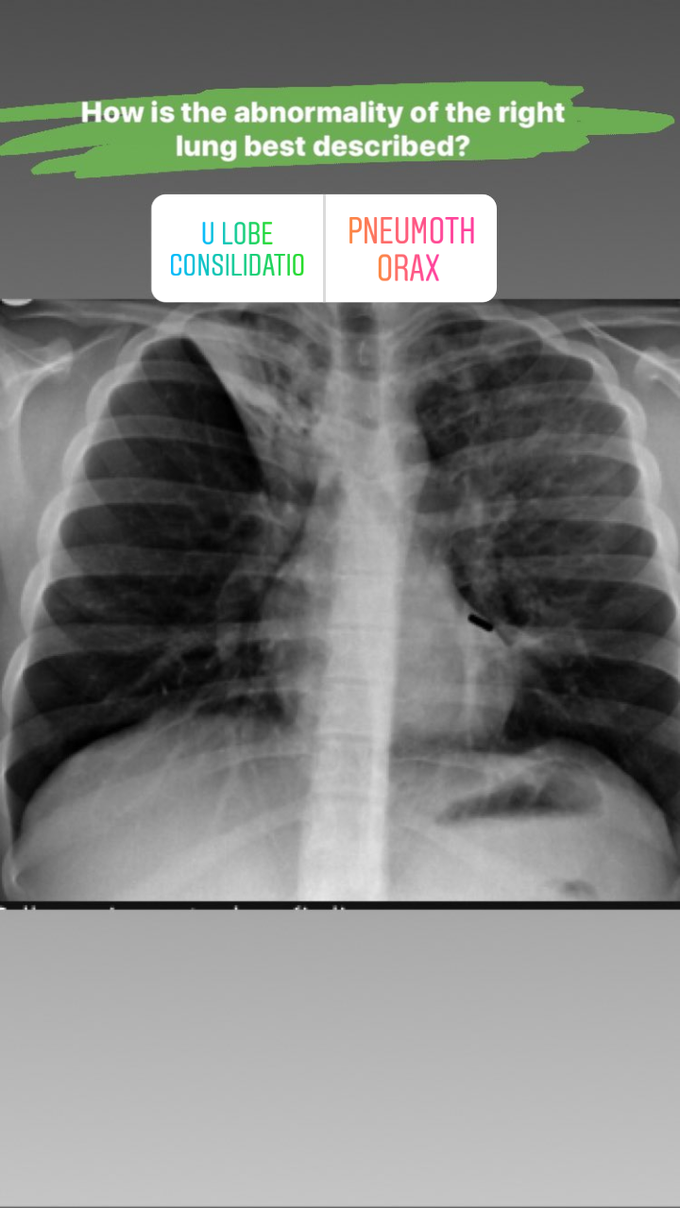 Abnormality