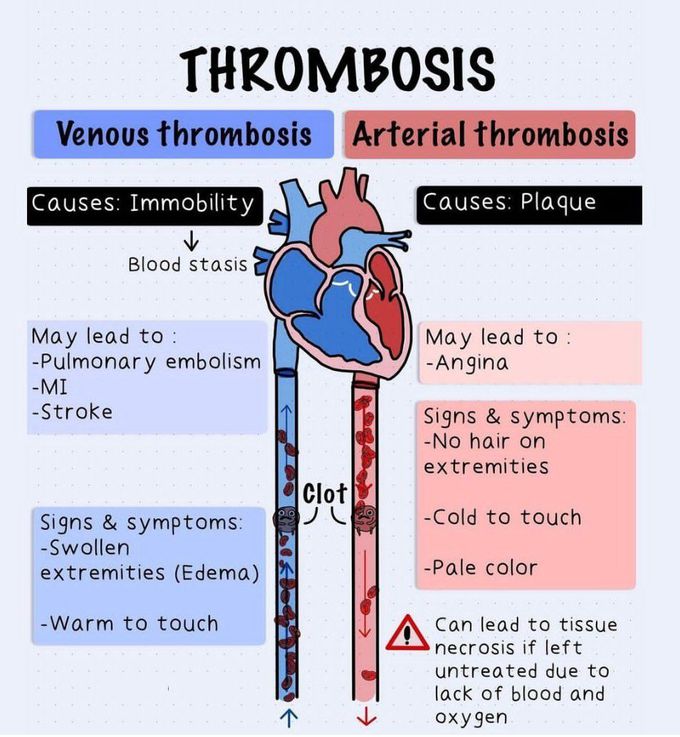 Thrombosis