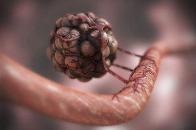 A tumor cell creating its own blood supply