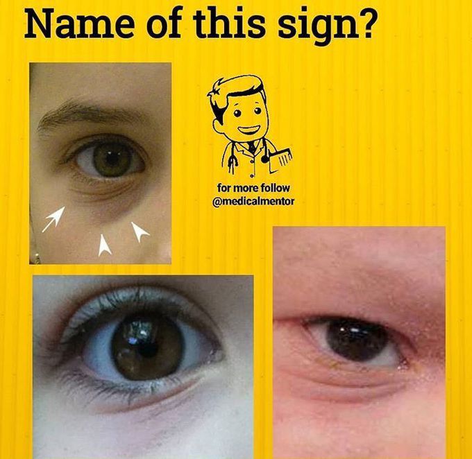 What is the name of this sign ?