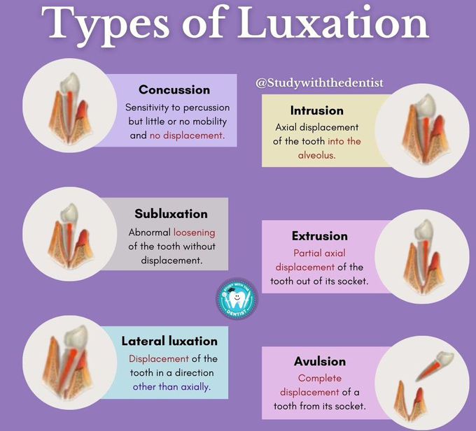 Types of Luxations