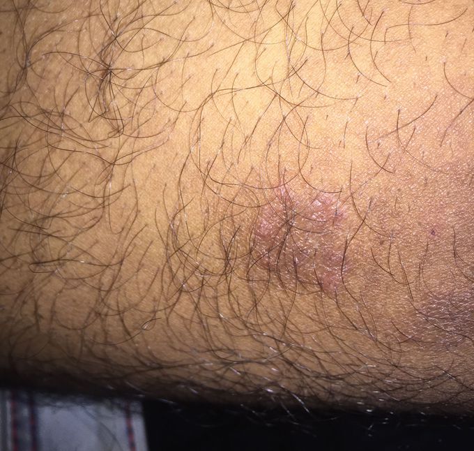 What your diagnosis??