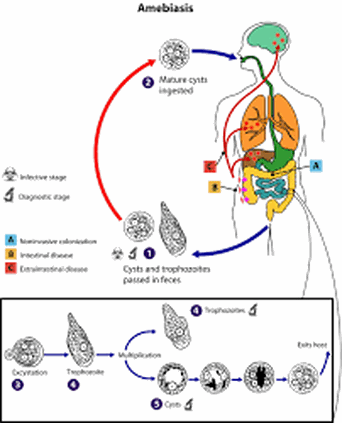 Symptoms and transmission of amebic liver abcess