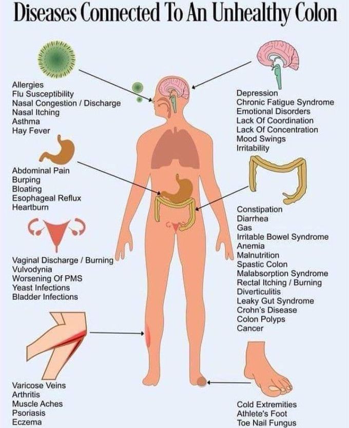 Unhealthy colon