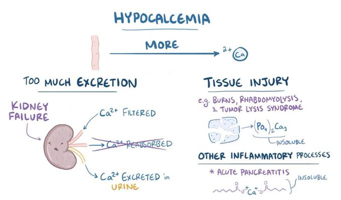 Hypocalcemia