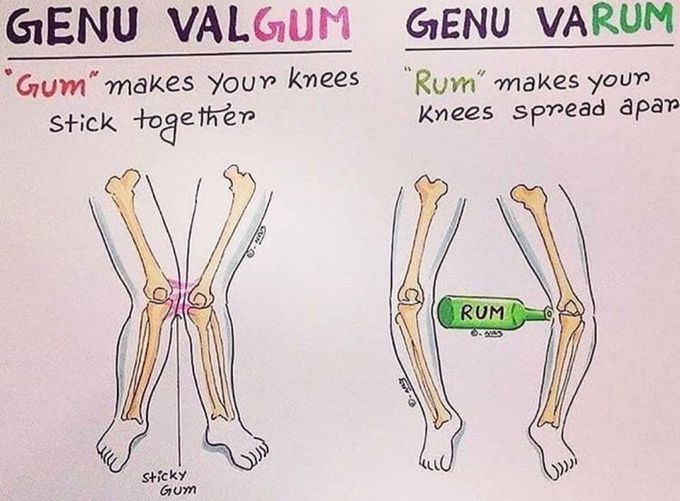 Bone deformities