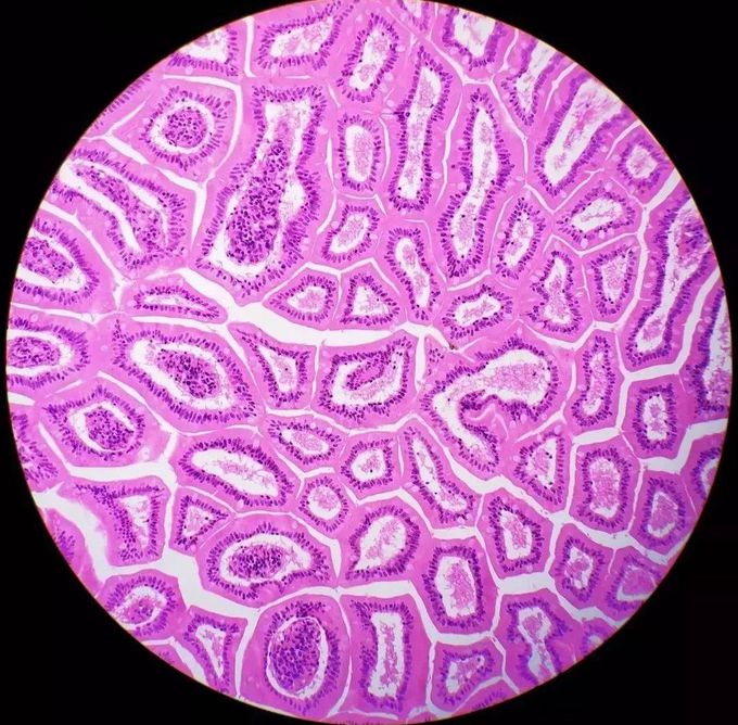 Jejunum With Villi