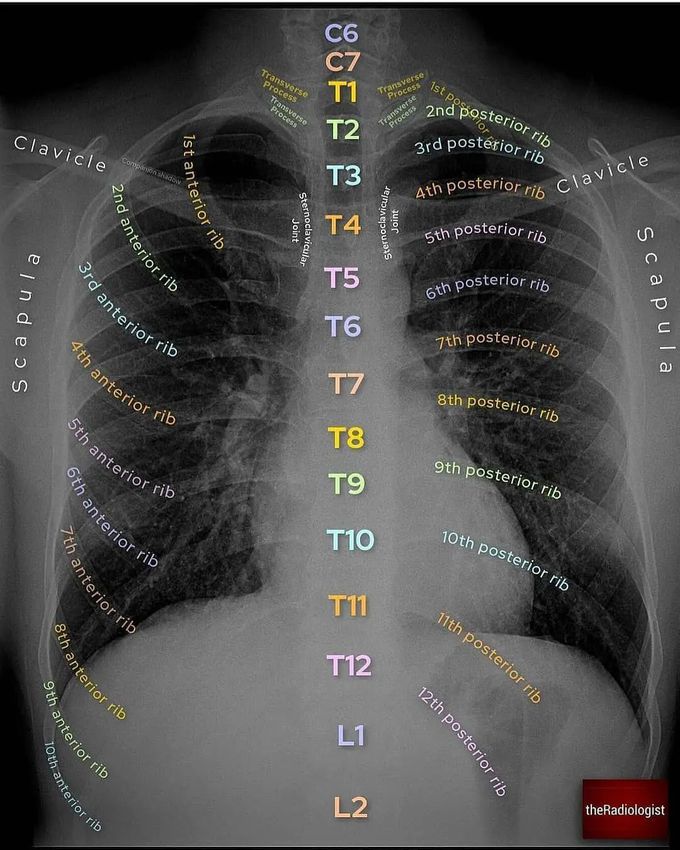 Chest X-ray