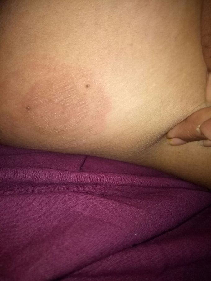 Diagnosis????