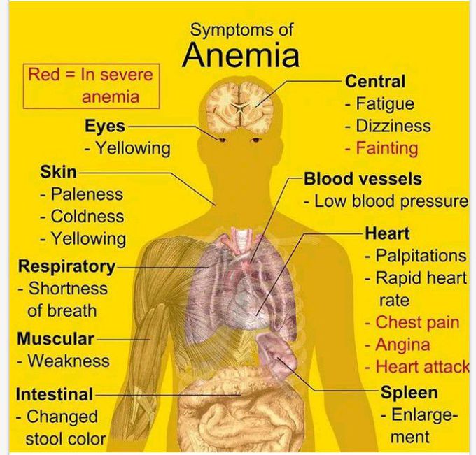 Anemia's symptoms