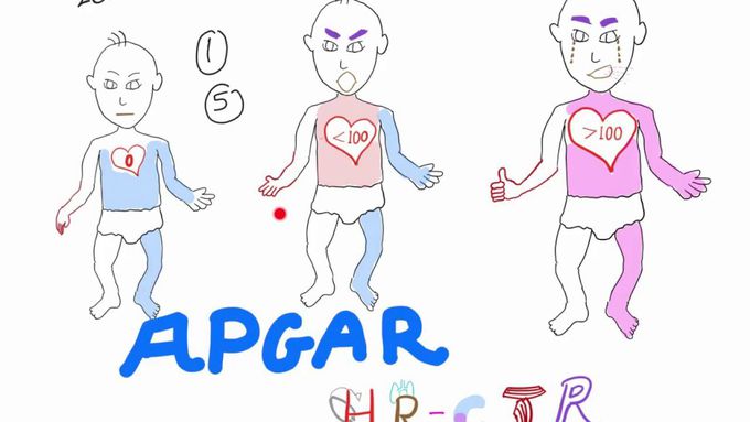 APGAR score-made easy.