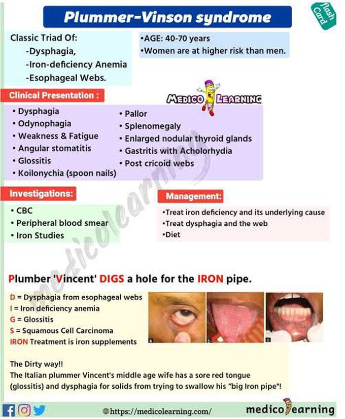 Plummer Vinon Syndrome