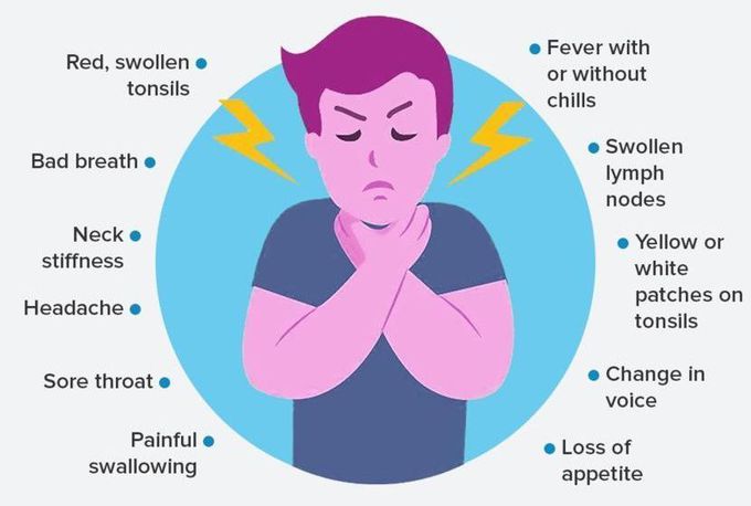 Symptoms of Tonsillitis