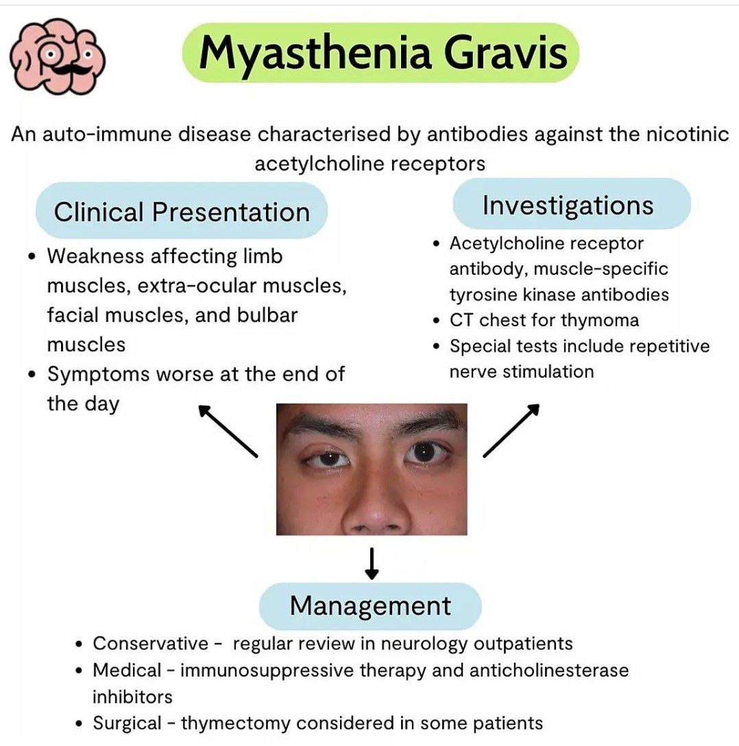 Myasthenia Gravis Medizzy 9522