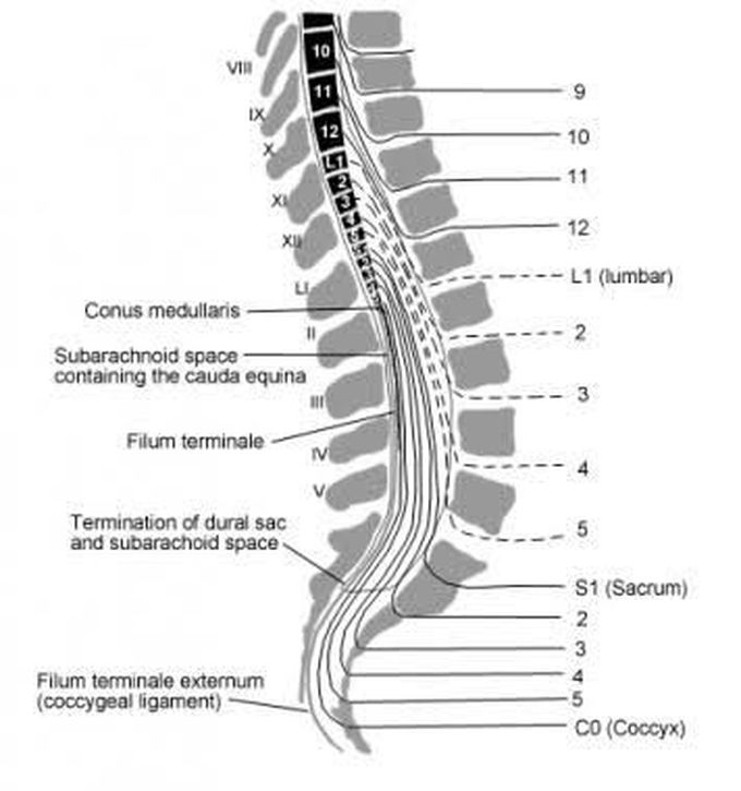 Spinal anaesthetic