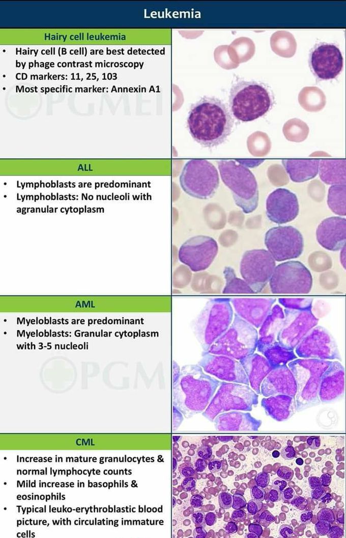 WBC disorders