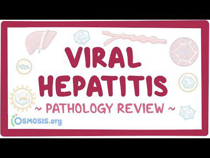 Viral hepatitis | Pathology Review
