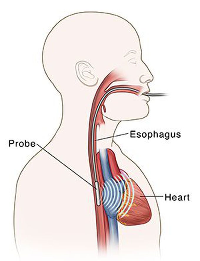 What's the name of this process??
