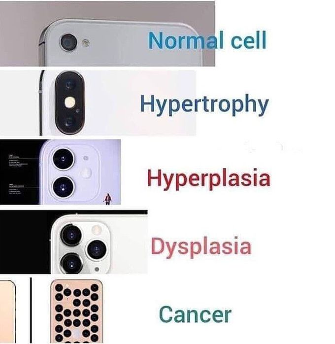 What do you think about?