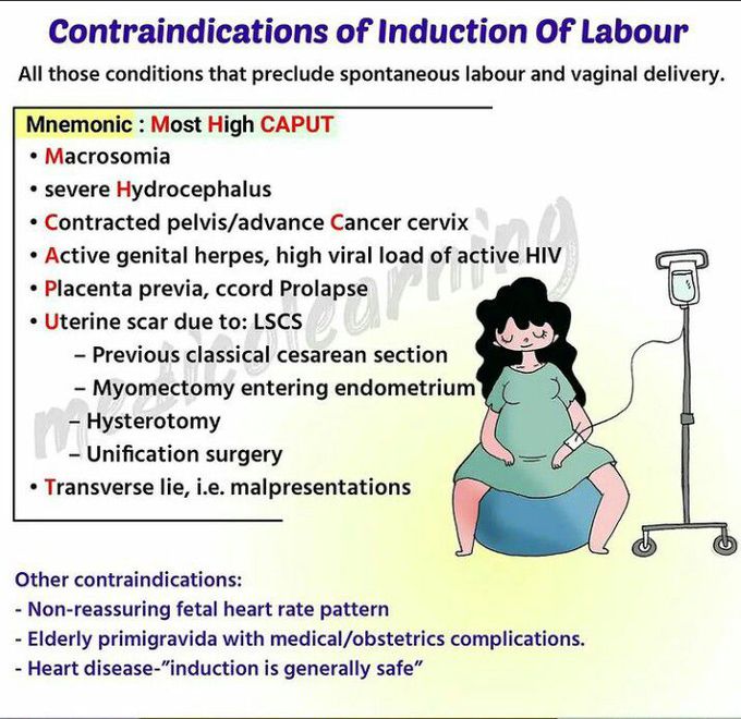 Contraindications of induction of Labour