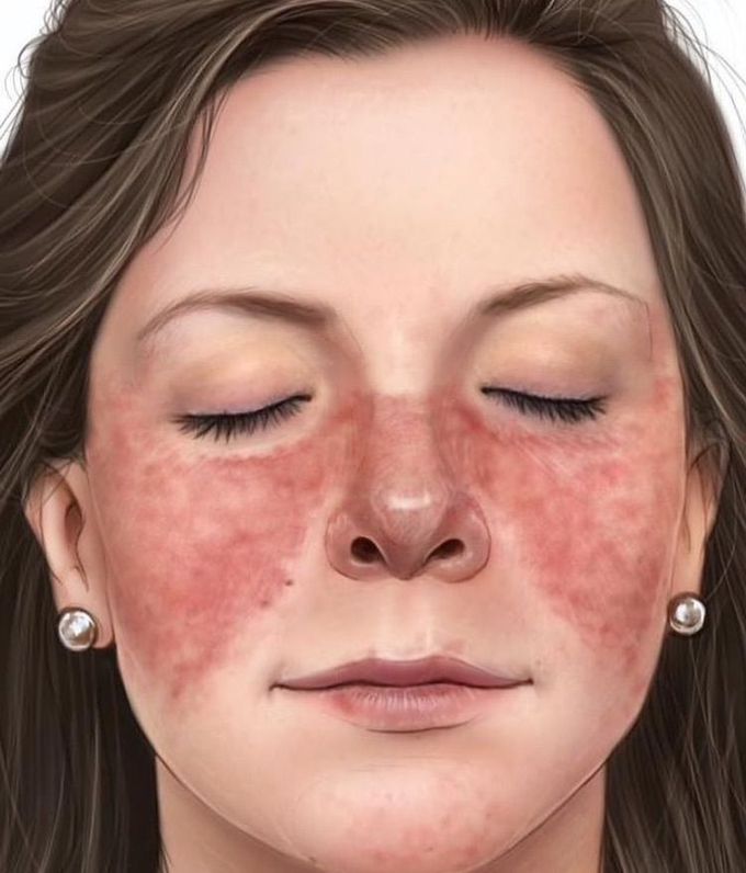 What is the name of this condition ?