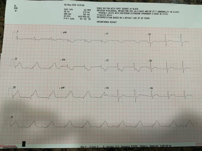 a patient with a history of hypertension reports nausea