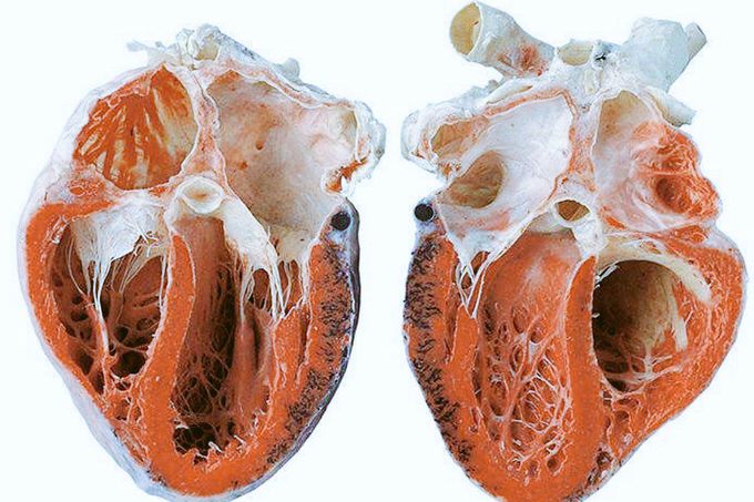 ❤️A transverse section of a human heart ❤️