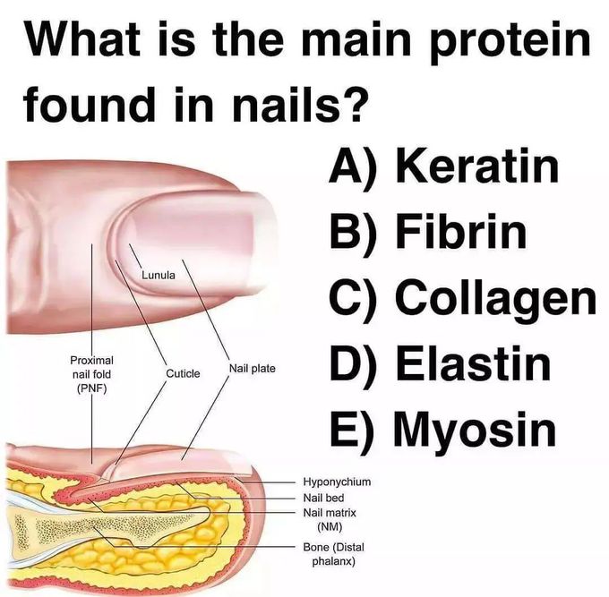 Identify the Protein