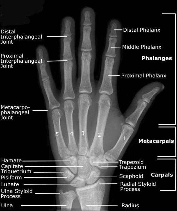 x ray wrist