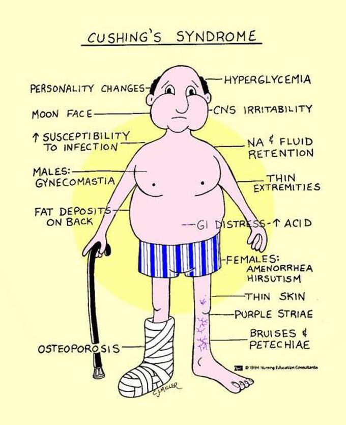 Also called hypercortisolism, A condition that occurs from exposure to high cortisol levels for a long time.most common cause is use of steroidal drugs,but can also happen due to over production of cortisol from the adrenal glands