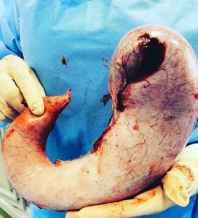 general surgery