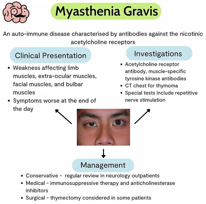 Myasthenia gravis medizzy