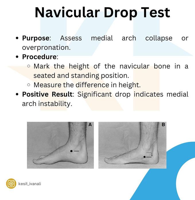 Navicular Drop Test