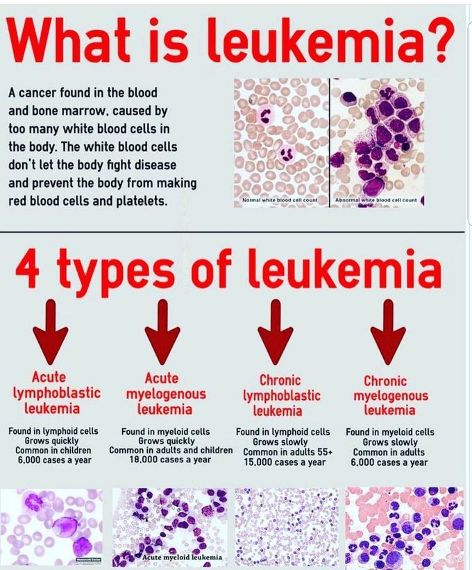 Leukemia
